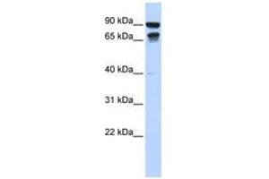 Image no. 1 for anti-Male-Specific Lethal 3 Homolog (MSL3) (N-Term) antibody (ABIN6740626) (MSL3 anticorps  (N-Term))