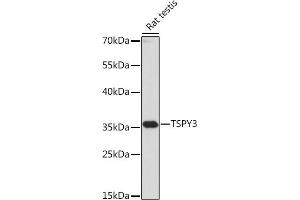 Western blot analysis of extracts of Rat testis, using TSPY3 antibody (ABIN7270776) at 1:1000 dilution. (TSPY3 anticorps  (AA 1-308))