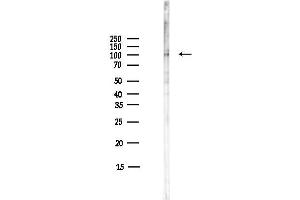anti-Cadherin 11 (CDH11) (Internal Region) antibody