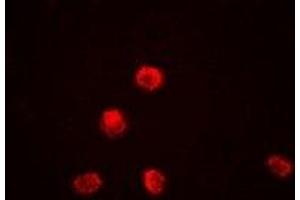 Immunofluorescent analysis of KDM1A staining in Jurkat cells. (LSD1 anticorps)