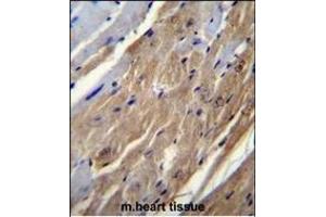 FGF16 Antibody (N-term) (ABIN655807 and ABIN2845234) immunohistochemistry analysis in formalin fixed and paraffin embedded mouse heart tissue followed by peroxidase conjugation of the secondary antibody and DAB staining.