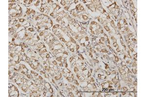 Immunoperoxidase of monoclonal antibody to ACTB on formalin-fixed paraffin-embedded human stomach. (beta Actin anticorps  (AA 1-375))