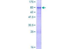 Image no. 1 for Zinc Finger Protein 20 (ZNF20) (AA 1-497) protein (GST tag) (ABIN1325964)