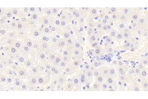 Detection of vWA1 in Rat Liver Tissue using Polyclonal Antibody to Von Willebrand Factor A Domain Containing Protein 1 (vWA1)