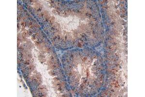 Used in DAB staining on fromalin fixed paraffin- embedded testis tissue