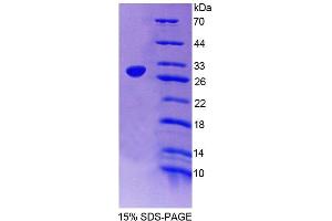 SDS-PAGE analysis of Rat NXF1 Protein. (NXF1 Protéine)