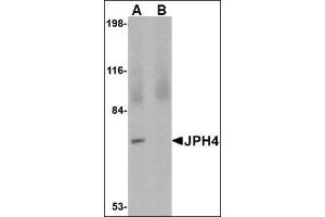 Western blot analysis of JPH4 in 293 cell lysate with this product at 1 μg/ml in (A) the absence and (B) the presence of blocking peptide. (Junctophilin 4 anticorps  (C-Term))