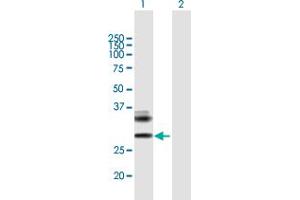Western Blot analysis of RAET1E expression in transfected 293T cell line by RAET1E MaxPab polyclonal antibody. (Retinoic Acid Early Transcript 1E (RAET1E) (AA 1-263) anticorps)