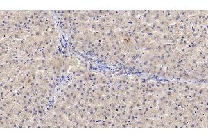 Detection of IL29 in Human Liver Tissue using Monoclonal Antibody to Interleukin 29 (IL29) (IL29 anticorps  (AA 20-200))