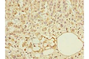 Immunohistochemistry of paraffin-embedded human adrenal gland tissue using ABIN7144926 at dilution of 1:100 (ABCF3 anticorps  (AA 201-500))