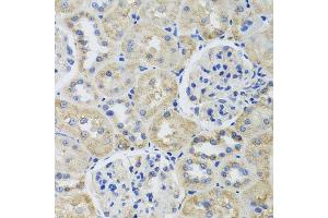 Immunohistochemistry of paraffin-embedded rat kidney using TUBB8 antibody.