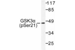 Image no. 1 for anti-Glycogen Synthase Kinase 3 alpha (GSK3a) (pSer21) antibody (ABIN318029) (GSK3 alpha anticorps  (pSer21))