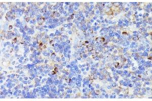 Immunohistochemistry of paraffin-embedded Rat lymph node using CCDC6 Polyclonal Antibody at dilution of 1:100 (40x lens). (CCDC6 anticorps)