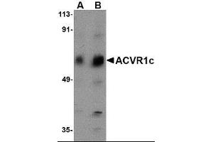 Western blot analysis of ACVR1C in human placenta tissue lysate with ACVR1C antibody at (A) 1 and (B) 2 ug/ml. (ACVR1 anticorps  (N-Term))