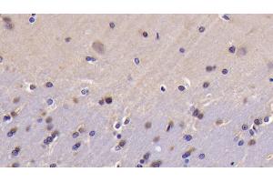 Detection of Bcl2L in Rat Cerebrum Tissue using Polyclonal Antibody to B-Cell CLL/Lymphoma 2 Like Protein (Bcl2L)