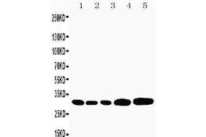 Anti-Caspase-3(P10) antibody,  Western blotting Lane 1: Rat Liver Tissue Lysate Lane 2: Rat Thymus Tissue Lysate Lane 3: Rat Spleen Tissue Lysate Lane 4: HEPA Cell Lysate Lane 5: NEURO Cell Lysate (Caspase 3 anticorps  (C-Term))