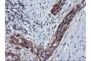 Image no. 1 for anti-Histidyl-tRNA Synthetase 2, Mitochondrial (Putative) (HARS2) antibody (ABIN1498585) (HARS2 anticorps)