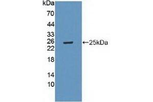 Detection of Recombinant LAMa4, Mouse using Polyclonal Antibody to Laminin Alpha 4 (LAMa4) (LAMa4 anticorps  (AA 745-940))