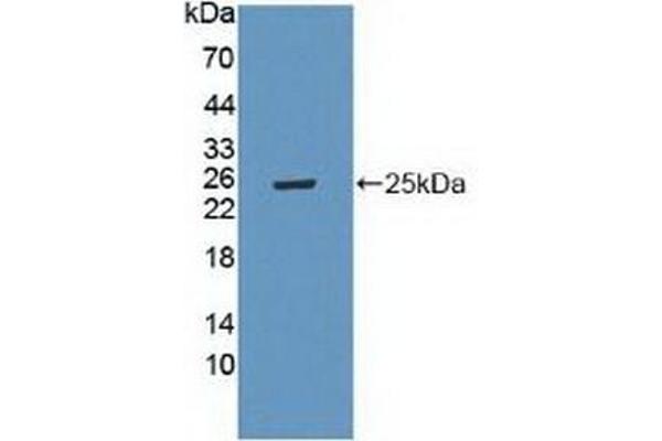 LAMa4 anticorps  (AA 745-940)