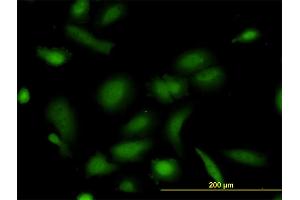 Immunofluorescence of monoclonal antibody to NUDC on HeLa cell.