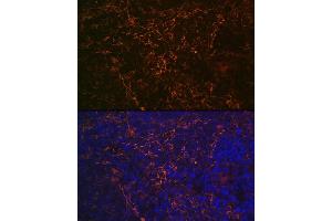 Immunofluorescence analysis of rat spleen using CD23 Rabbit mAb (ABIN7267160) at dilution of 1:100 (40x lens).