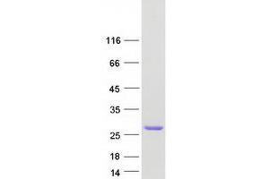 Validation with Western Blot