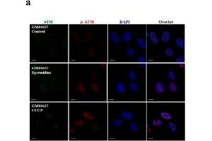 Immunocytochemistry (ICC) image for anti-Ataxia Telangiectasia Mutated (ATM) (AA 1974-1988), (pSer1981) antibody (ABIN6656104)
