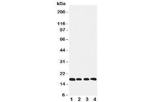 Western blot testing of Cyclophilin B antibody and Lane 1:  rat ovary (PPIB anticorps  (C-Term))
