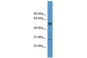 WB Suggested Anti-Ppp2r2c Antibody Titration: 0. (PPP2R2C anticorps  (N-Term))