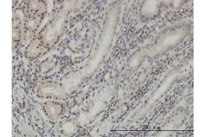 Immunoperoxidase of monoclonal antibody to DLX2 on formalin-fixed paraffin-embedded human stomach. (DLX2 anticorps  (AA 1-110))