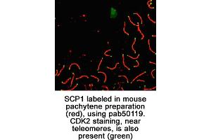 Image no. 1 for anti-Synaptonemal Complex Protein 1 (SYCP1) (C-Term) antibody (ABIN363428) (SYCP1 anticorps  (C-Term))