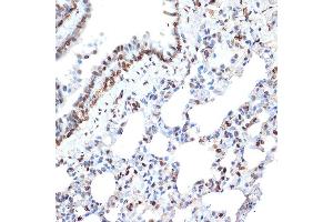 Immunohistochemistry of paraffin-embedded rat lung using Histone H2A Rabbit mAb (ABIN7267703) at dilution of 1:100 (40x lens). (HIST1H2AE anticorps)
