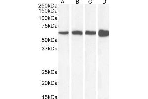 (ABIN185651) (0. (Catalase anticorps  (Internal Region))