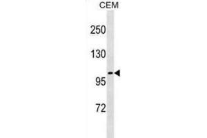 Western Blotting (WB) image for anti-Unc-5 Homolog C (C. Elegans) (Unc5c) antibody (ABIN3001210) (Unc5c anticorps)