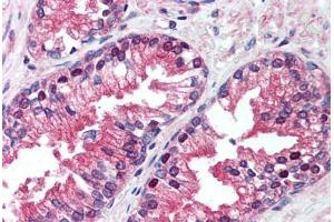 Human Prostate (formalin-fixed, paraffin-embedded) stained with VCP antibody ABIN239859 at 5 ug/ml followed by biotinylated anti-mouse IgG secondary antibody ABIN481714, alkaline phosphatase-streptavidin and chromogen. (VCP anticorps)