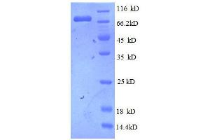 Epidermal Growth Factor Receptor (EGFR) (AA 26-645), (partial) protein (His tag)
