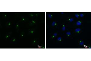 ICC/IF Image RAB6A antibody detects RAB6A protein at Golgi apparatus by immunofluorescent analysis.