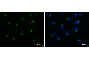 ICC/IF Image RAB6A antibody detects RAB6A protein at Golgi apparatus by immunofluorescent analysis. (RAB6A anticorps)