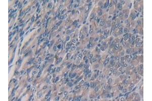 Detection of MCSF in Mouse Stomach Tissue using Polyclonal Antibody to Colony Stimulating Factor 1, Macrophage (MCSF)