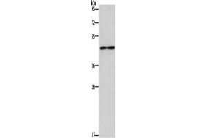 Western Blotting (WB) image for anti-Interleukin 5 Receptor, alpha (IL5RA) antibody (ABIN5546745) (IL5RA anticorps)