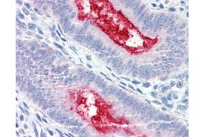 Anti-ENPP3 antibody IHC of human uterus.