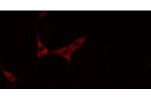 ABIN6269377 staining NIH-3T3 cells by IF/ICC. (TRKB anticorps  (C-Term))