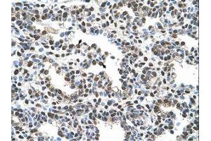 Image no. 1 for anti-Advanced Glycosylation End Product-Specific Receptor (AGER) (AA 251-300) antibody (ABIN6736617)