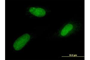 Immunofluorescence of purified MaxPab antibody to TTRAP on Hs 181.