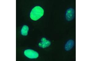 IF analysis of UBE2S using anti-UBE2S antibody (ABIN7602116). (UBE2S anticorps  (AA 6-155))