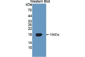 Figure. (TNFRSF19 anticorps  (AA 35-160))