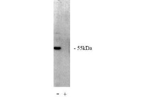 Image no. 1 for anti-Protein Phosphatase 2, Regulatory Subunit A, beta (PPP2R1B) antibody (ABIN264940) (PPP2R1B anticorps)