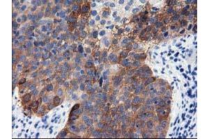 Immunohistochemical staining of paraffin-embedded Human pancreas tissue using anti-ALDH1L1 mouse monoclonal antibody. (ALDH1L1 anticorps)