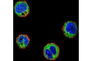 Confocal immunofluorescent analysis of MDA-MB435 cells using NFKBIL1  Antibody  (C-term), followed by Alexa Fluor 488-conjugated goat anti-rabbit lgG (green).