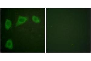 Immunofluorescence analysis of HuvEc cells, using Caveolin-1 Antibody. (Caveolin-1 anticorps  (AA 129-178))